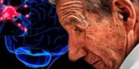 وجود توده های کلسیم در مغز نشانه پارکینسون است