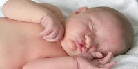 امکان شناسایی جنین لب شکری با سونوگرافی