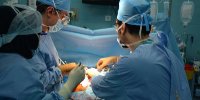 حیات ۲۵ هزار بیمار در گرو پیوند عضو/سهم بیماران دیالیزی