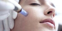 خطرات چال گونه ایجادشده توسط جراحی