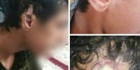محرومیت مادام العمر عاملان شکستن گوش کشتی‌گیران نوجوان