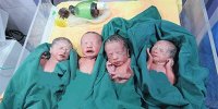 تولد چهارقلوها در کالپوش رانش دیده