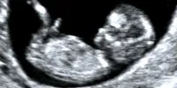 سونوگرافیِ یادگاری، ممنوع