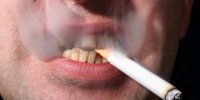 دخانیات و الکل از علل اصلی سرطان‌های دهان/هشدار درباره آدامس‌های نیکوتین‌دار