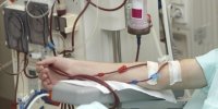 دستورالعمل خدمات پس از فروش دستگاه‌های همودیالیز و تصفیه آب دیالیز به روز شد