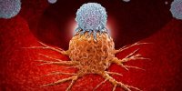 سرطان گردنه رحم با ویروس HPV ارتباط دارد