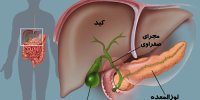 تشخیص سرطان لوزالمعده :چطور بفهمیم لوزالمعده مان بیمار است؟
