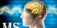چه‌ كنيم كه ام‌اس نگيريم؟