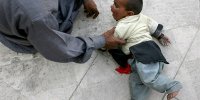 متکدیان در پاکستان به طور حرفه‌ای و تعمدی فلج می‌شوند