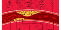 این 10 علامت یعنی کلسترول خونتان بالاست