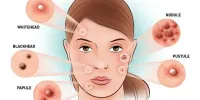 مضرات شستشوی بیش از حد صورت چیست؟