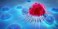 با این رژیم غذایی سرطان پوست را فراموش کنید
