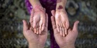 اعلام جزئیات طرح دارو رسان برای بیماران خاص در تهران
