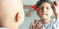 شایع‌ترین سرطان‌ها در بین زنان،مردان و کودکان ایرانی