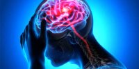 علائم هشداردهنده پیش از سکته مغزی