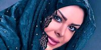 چه بلایی بر سر چهره فلور نظری آمده است؟ + عکس
