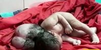 تولد نوزاد عجیب 3 سر در هندوستان!