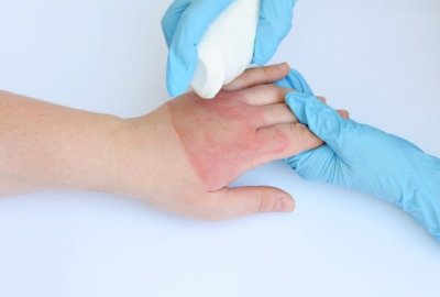 زندگی عادی برای کودکان خاص | افتتاح نخستین درمانگاه فوق‌تخصصی جراحی ترمیمی کودکان؛ از شکاف لب تا سوختگی و بدشکلی