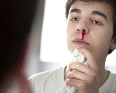 اینفوگرافیک | کمک‌های اولیه برای توقف خونریزی بینی