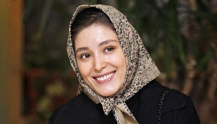 عکس | صورت کبود فرشته حسینی با چشم خون‌ریزی کرده!