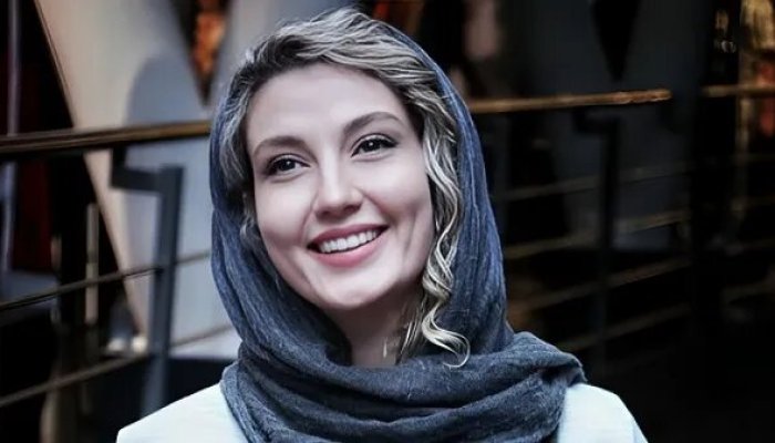 عکس | تغییر چهره دور از انتظار و عجیب بازیگر زن ایرانی